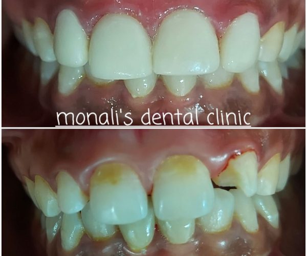 Photo from Monali_s Dental Clinic